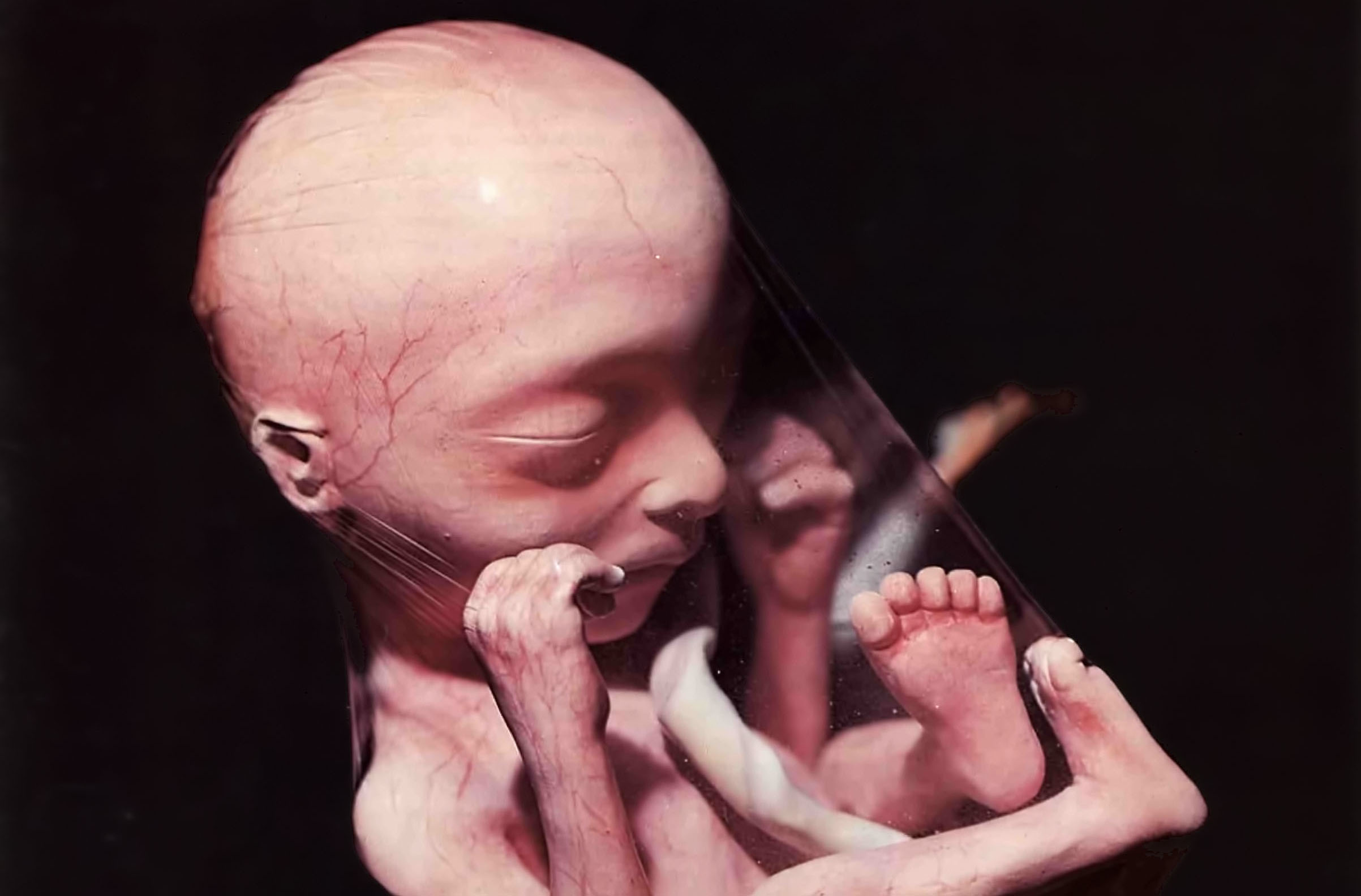 Abortion. No--It's A Child!! | Krishna.org2405 x 1583
